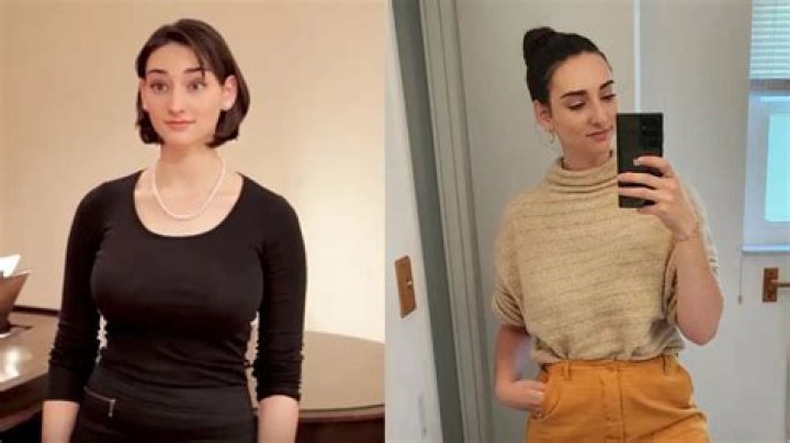 Abby Shapiro Plastic Surgery: Shapiro's Changing Expectations from Her Body!