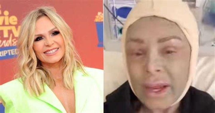 All Facts About Christopher Judge Plastic Surgery