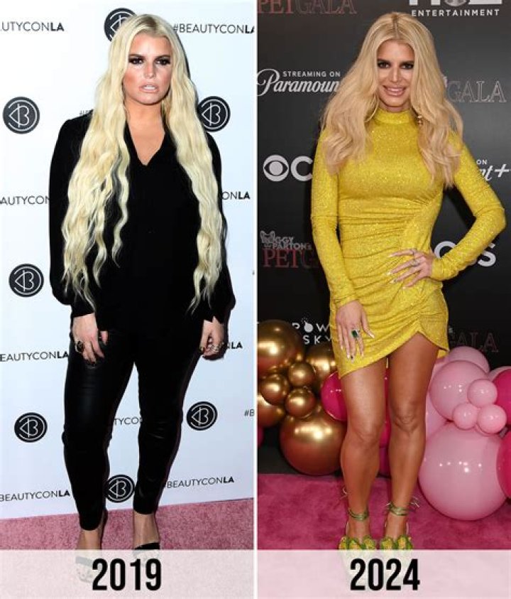 Amy Schumer Reacts To Jessica Simpson Baby Weight Loss Post With Hilarious Joke That Has Fans Applauding The Comedian