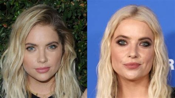 Ashley Benson Opens Up About Plastic Surgery Speculation: “She feels more confident and healthy”
