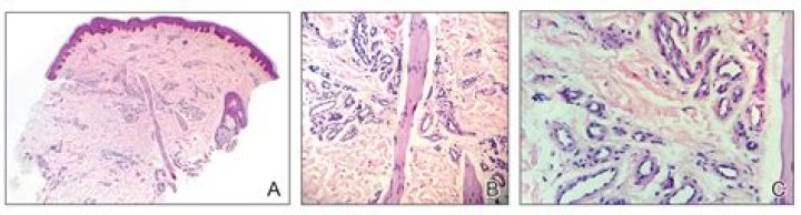 Dr. Carlos Nousari, MD – Davie, FL