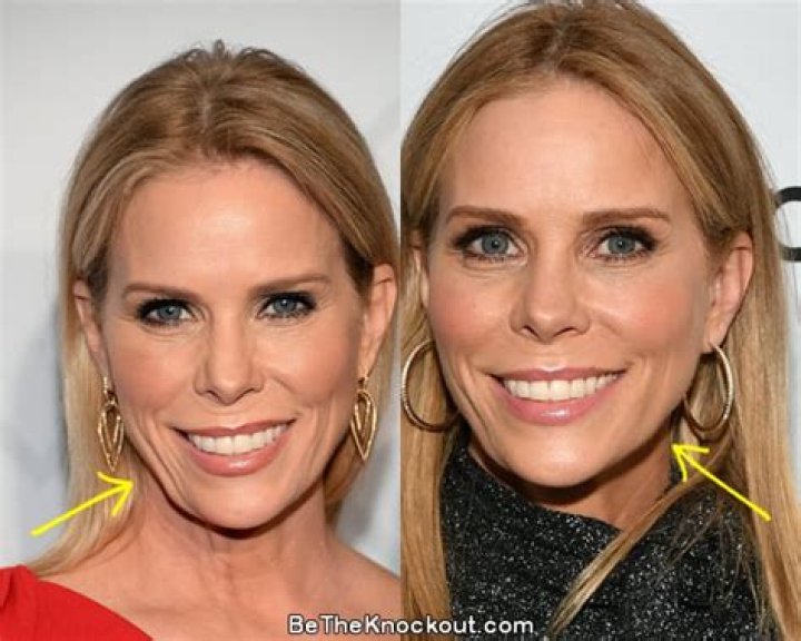 Cheryl Hines Plastic Surgery: Medical Treatments Make Her Happy?