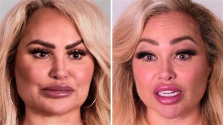 Darcey and Stacey Before and After Plastic Surgery: Photos and Transformation Update