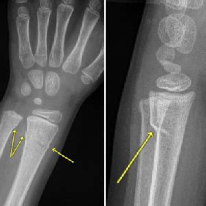 WJW anchor Dave Buckel cause of death, age, wife, children, net worth