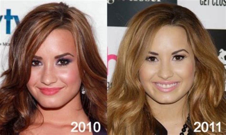 Demi Lovato Breast Implants & Nose Job Plastic Surgery Before and After