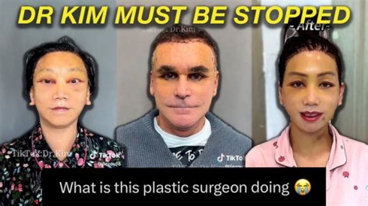 Dr. Kim plastic surgery TikTok, explained
