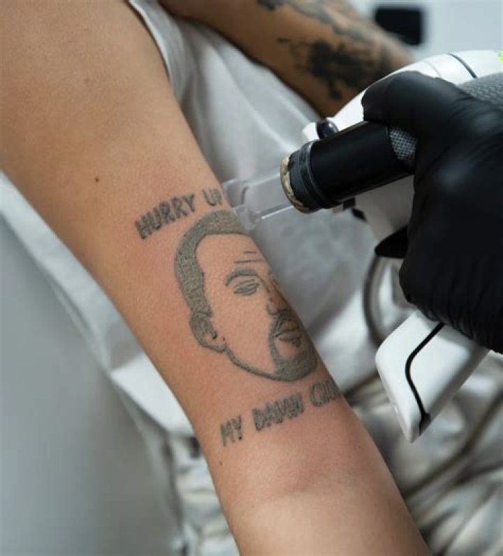 For reasons that should be blindingly obvious a tattoo studio is offering free removal of any Kanye West tattoos