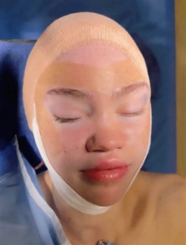 Grimes Published A Selfie, Which Fueled Rumours That She Had Her Elf Ears Surgically Altered