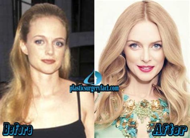 Heather Graham Plastic Surgery: Heather's Self-Care Routine or Artificial Procedures?