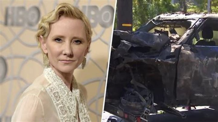 
How Is Anne Heche Condition Now After The Wild Car Accident In LA? What Happened? 