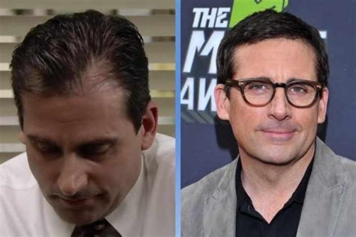 
Is Steve Carell Bald? Hair Loss And Health 2023 