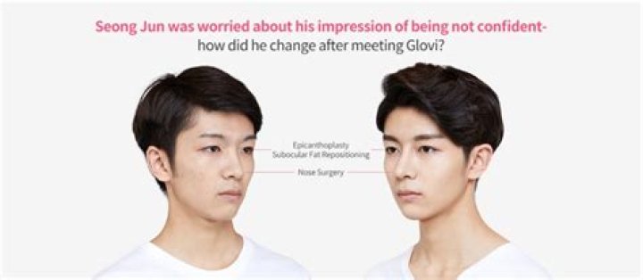 Jeon Jong-seo Plastic Surgery Before And After- Who Is Her Boyfriend Lee Chung-hyun?