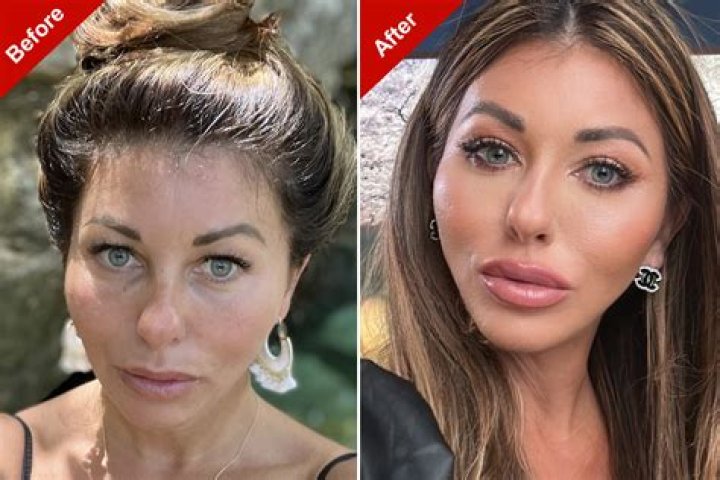 Jodie Joe Before And After Surgery Photos On Instagram, What Surgery Did She Have?