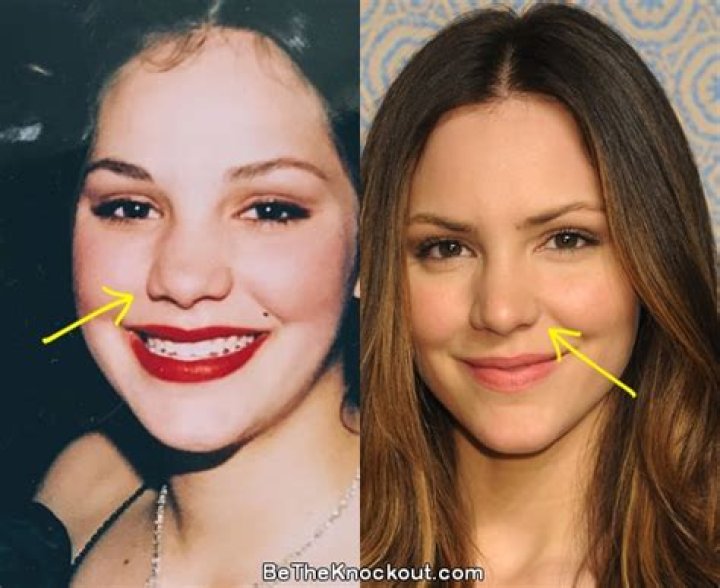 Katharine McPhee Plastic Surgery: From Nose Job to Fillers, Augmentations and What Not?