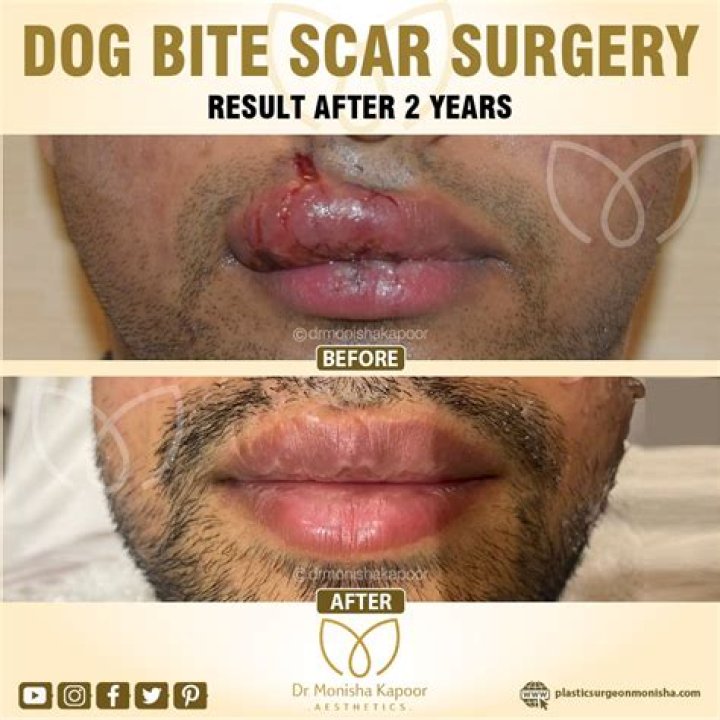 Kim Zolciak Says Her Son Kash Is ‘The Bravest Boy’ Following His Reconstructive Surgery Post-Dog Bite
