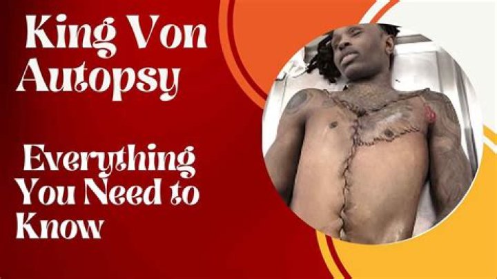 King Von Autopsy Leak Photos Shared On Reddit