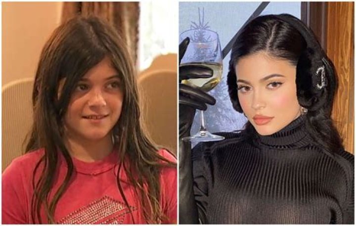 KUWTK: Kylie Jenner Says That Lip Fillers Helped With Her Insecurities!