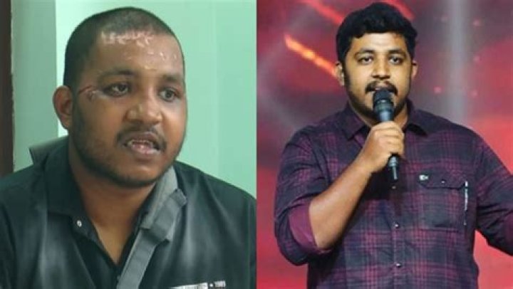 Mahesh Kunjumon Accident Face And Teeth Injury Leading To Surgery