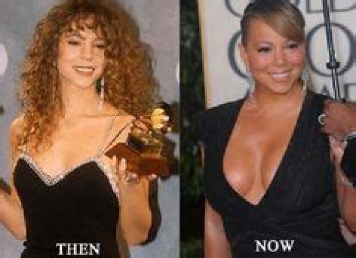 Mariah Carey Breast Implants Plastic Surgery Before and After