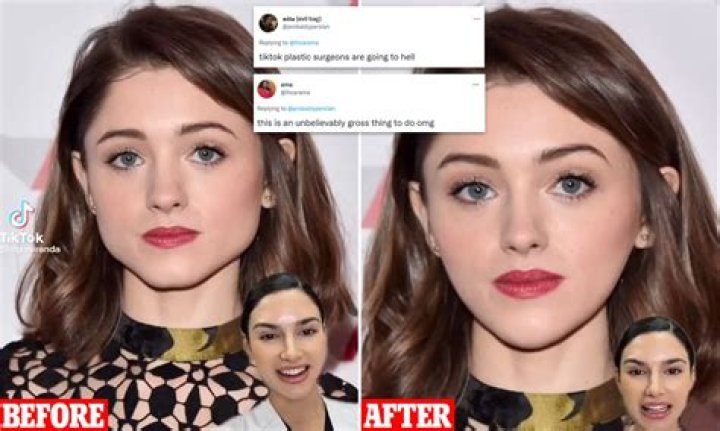 Fans rush to defend ‘Stranger Things’ star Natalia Dyer after a TikTok cosmetic beauty nurse suggests how she can ‘fix’ her face