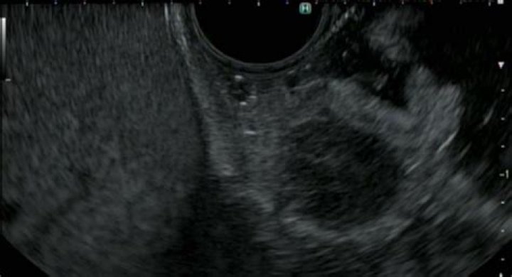 Dr. Negar Yaghooti, MD – South San Francisco, CA