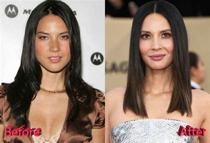 Olivia Munn Plastic Surgery: Olivia's Procedural Journey and Beauty Secrets Revealed!