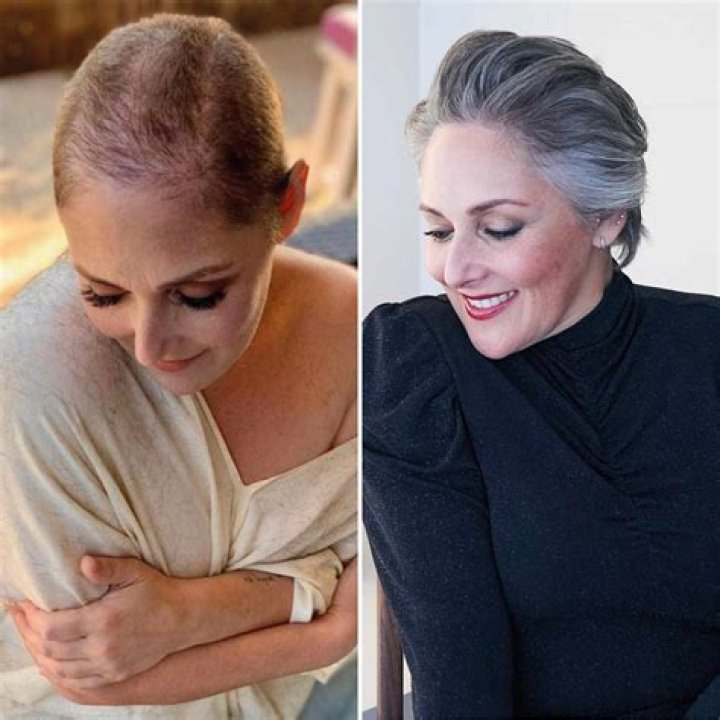 
Ricki Lake Shares ‘Raw Video’ Shaving Her Head Amid Years of Hair-Loss Struggles: ‘A Place of Peace’ 