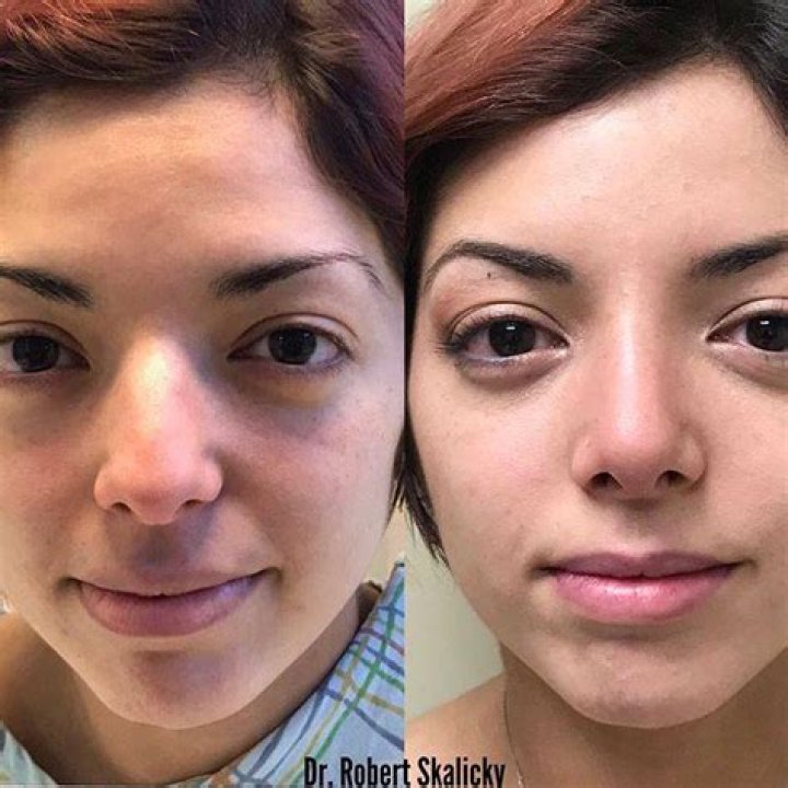 Dr. Robert Skalicky, DO – Newtown, PA