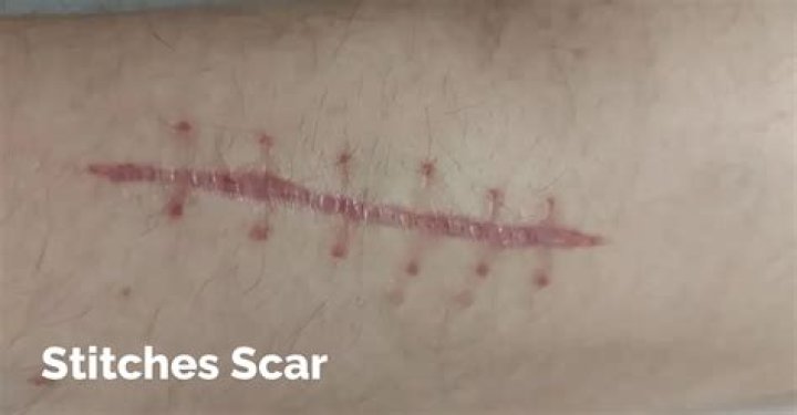 
What Happened To Bradley Martyn’s Face? Stitches And Scars Mark 