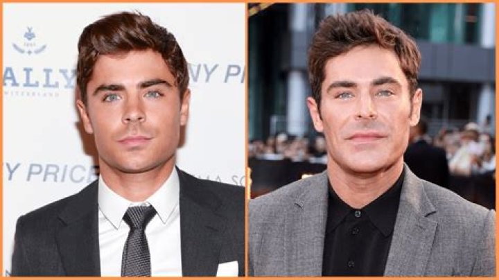 What Happened To Zac Efron Face After Car Accident: Jaw Injury Update, Before & After Plastic Surgery