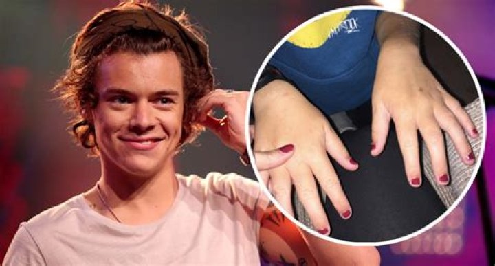 Why Does Harry Styles Paint His Nails? – Celebrity