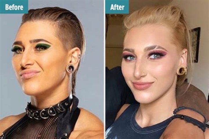 WWE Star Rhea Ripley No Makeup Look: Plastic Surgery Before And After